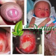 Illustration for article titled Jual Obat Kencing Nanah Di Surabaya